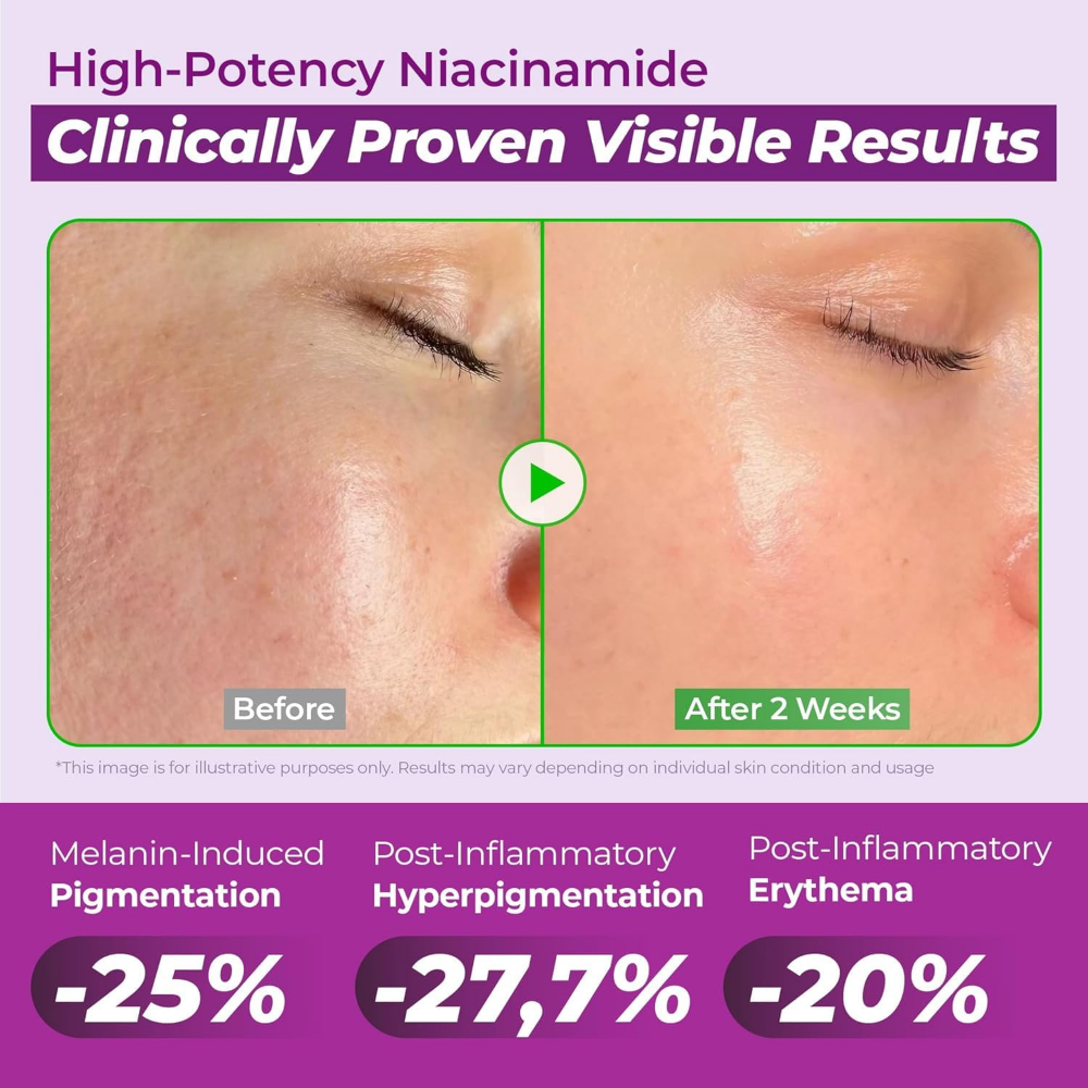 Jumiso Niacinamide 20 Serum 40ml
