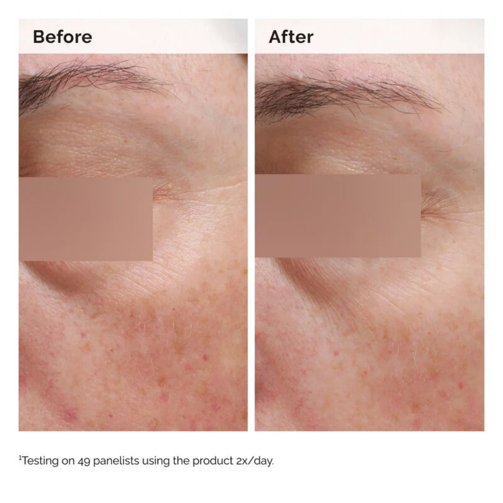 The Ordinary Niacinamide 5% Face & Body Emulsion 100ml