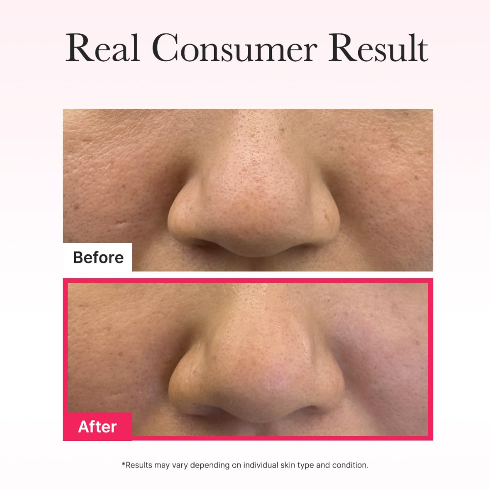 Arencia Red Collagen Jello Hydrogel Mask 4 x 25g