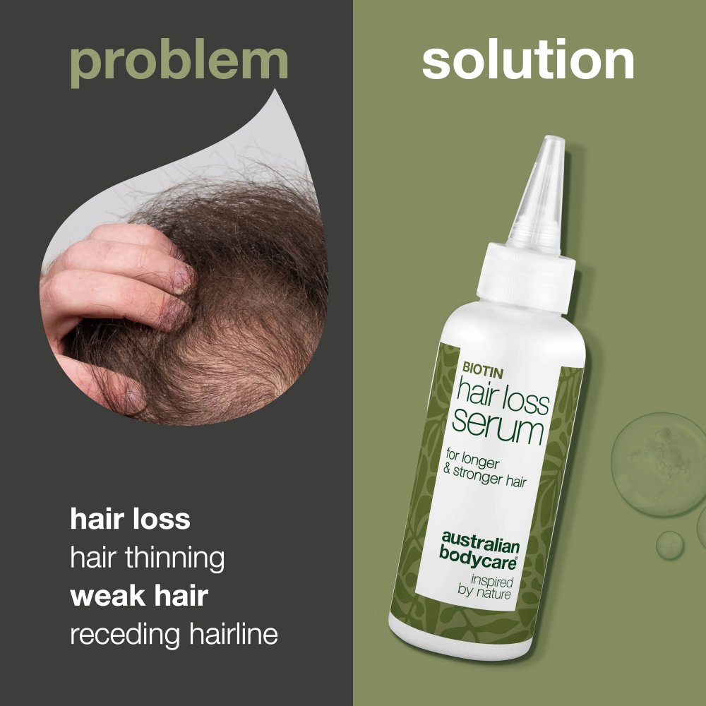 Australian Bodycare Biotin Hair Loss Serum 100ml