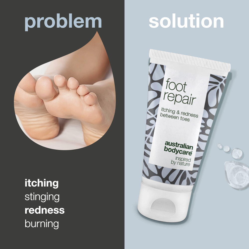 Australian Bodycare Foot Repair Gel 50ml