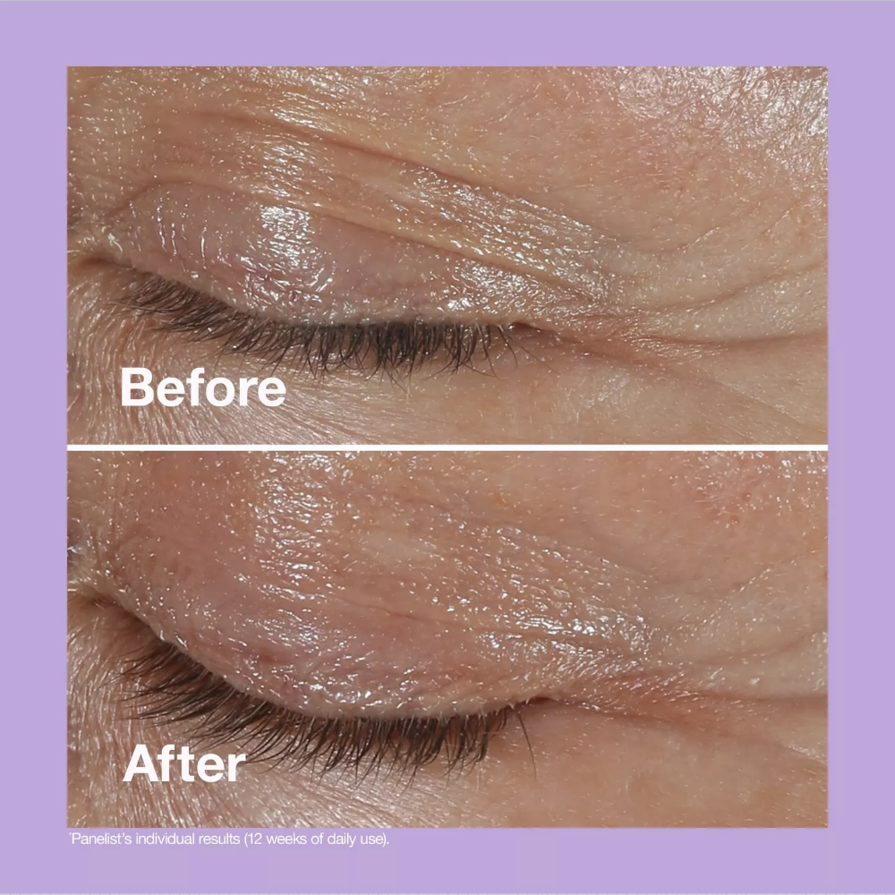 Clinique Smart Clinical Repair Wrinkle Correcting Eye Cream 30ml