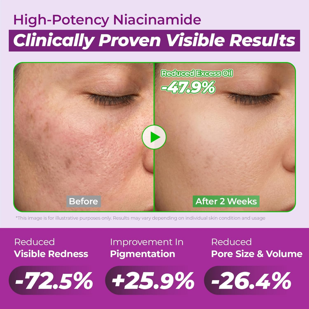 Jumiso Niacinamide 10 Serum 40ml