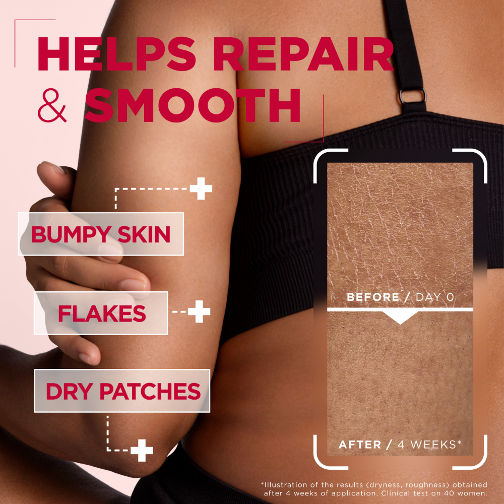 Mixa Urea Cica Repair+ Renewing Body Cream 150ml