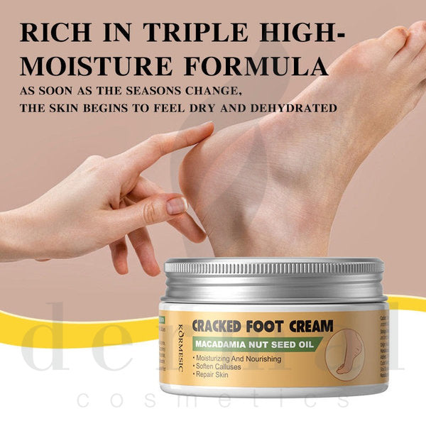 Macadamia-Nut-Oil-Cracked-Foot-Cream-Benefits-Kormesic