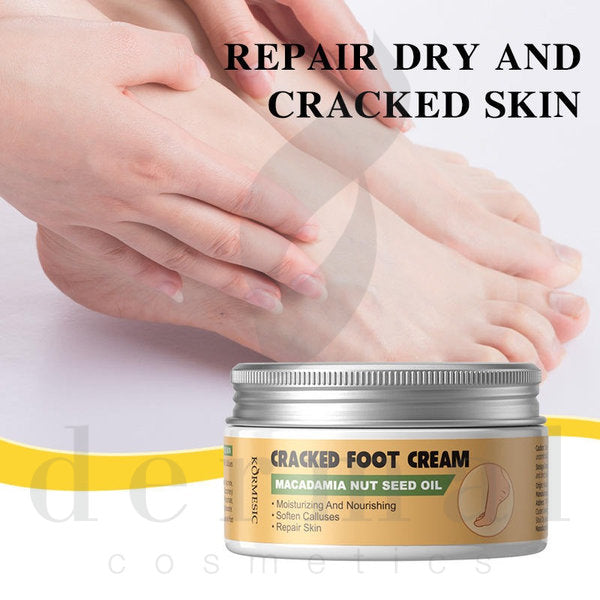 Macadamia-Nut-Oil-Cracked-Foot-Cream-Skin-Repair-Kormesic
