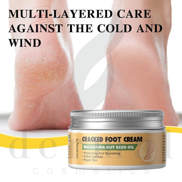Macadamia-Nut-Oil-Cracked-Foot-Cream-Two-Feet-Kormesic
