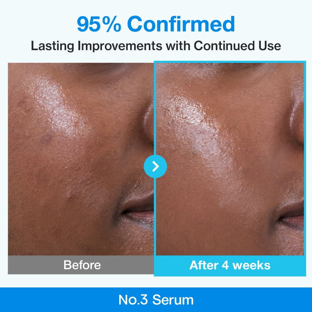 Numbuzin No. 3 Blue Bio-Retinol Pore Refining Serum 30ml