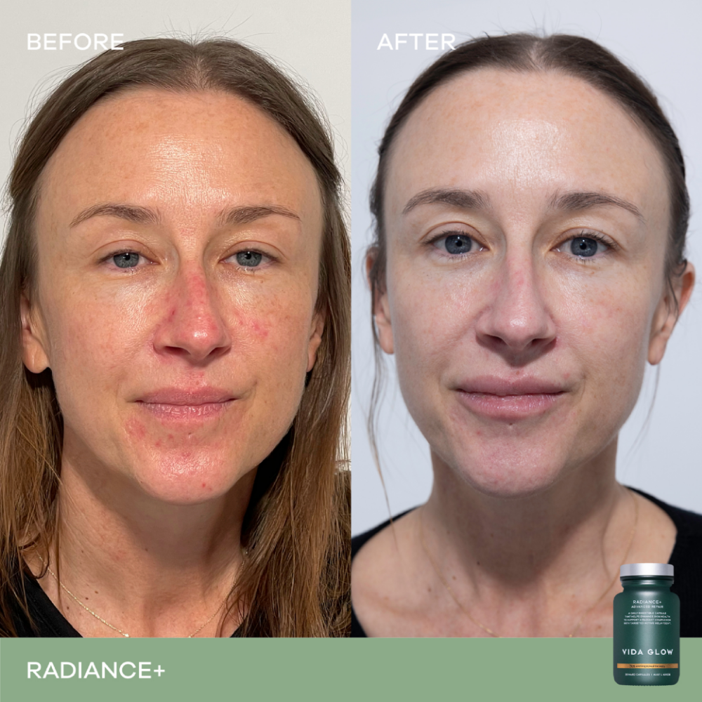 Vida Glow Radiance+ Advanced Repair Radiant Skin Supplement 30 Capsules